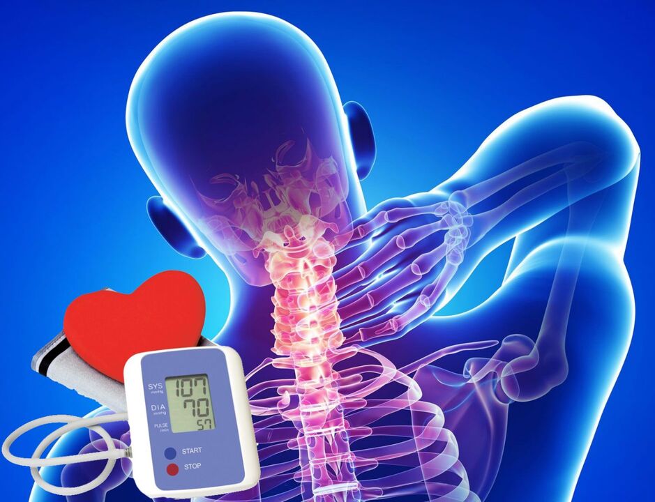 Osteochondrosisarentzako odol presioaren banaketa