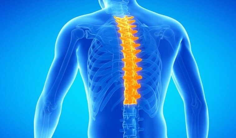 Bizkarrezurreko torakoaren osteochondrosia