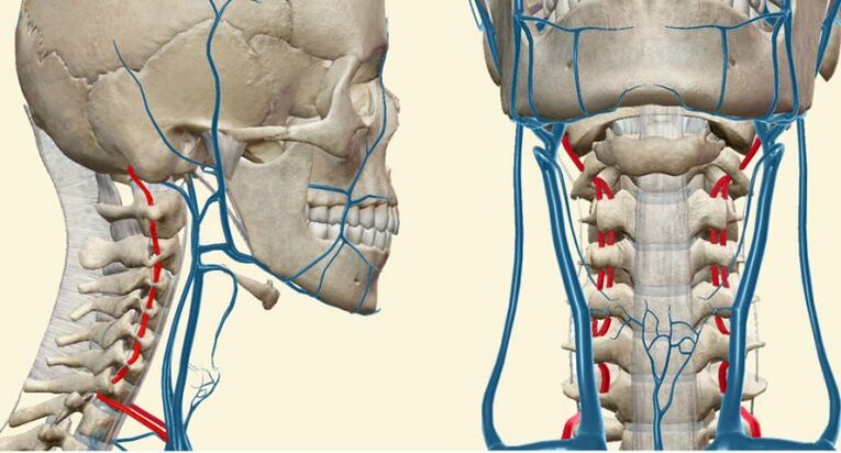 Sindrome baskularra osteokondrosian
